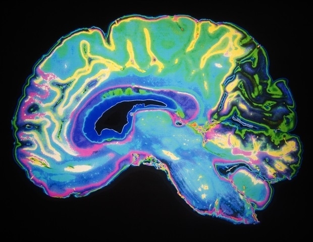 Artificially Colored MRI Scan Of Human Brain Daisy Daisy a8c5d8bbbf824bc8932308e30187510f 620x480 UKJrjh