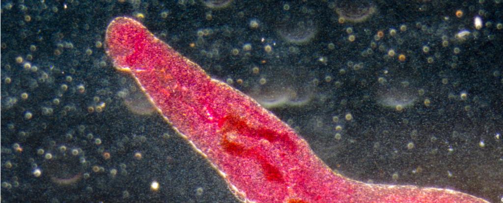 SchistosomaParasite